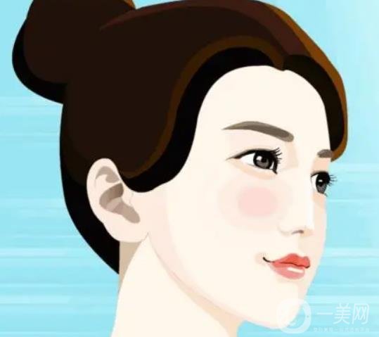 假體下巴多久恢復(fù)？恢復(fù)過程怎樣的？